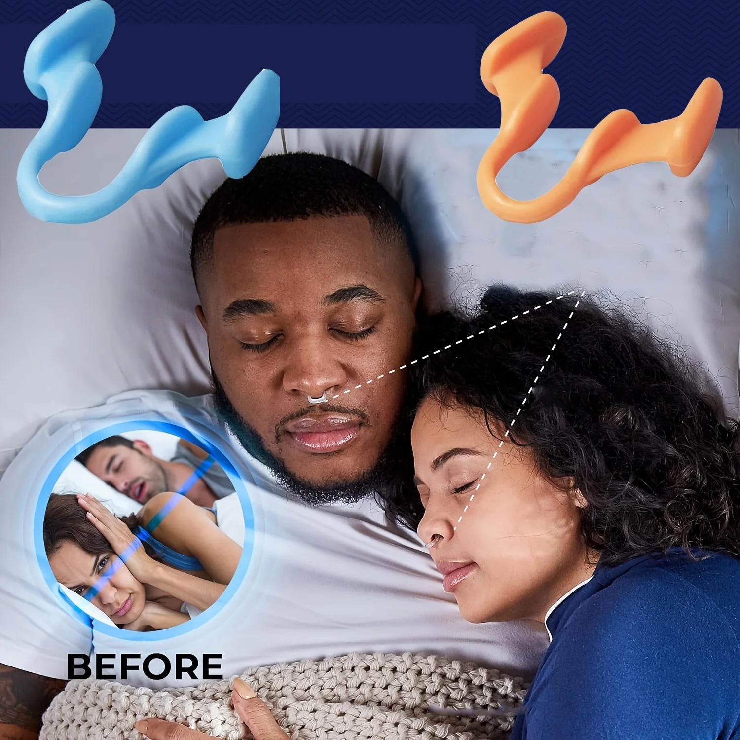Silicone Anti-Snoring Nose Expanders - 2 to 10 Pack Sleep Aid Clips for Enhanced Sleep Quality and Snoring Relief